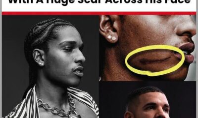 Drizzy revealed some secrets about how asap Rocky ended up with a huge scar across his face in a new diss track! Fans really think that it might go down at the superbowl 2025 where both rappers has confirmed that they will be attending!